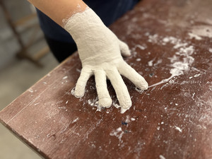 Jade's plastered hand